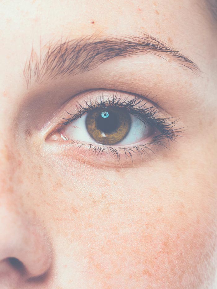 Floppy Eyelid Syndrome | Oasis Eye Face and Skin, Ashland, OR