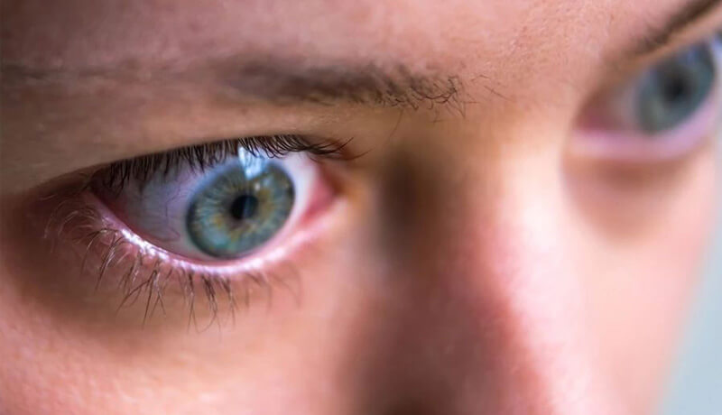 Close-up of an eye with a hint of eyelashes and skin texture.