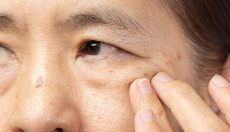 A close-up of a person's hand gently touching side of an eye.