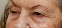 Mask group 1 Oasis Eye Face and Skin