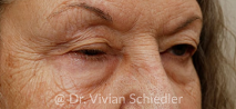 Mask group 2 Oasis Eye Face and Skin
