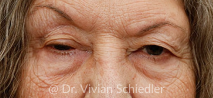 Mask group Oasis Eye Face and Skin